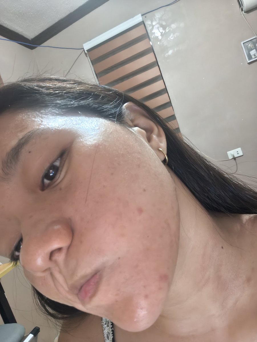 xenarella___'s tweet photo. Summer is my favorite season. Also, my breakout and heat rash season grrr https://t.co/9Xg6XpkDQa