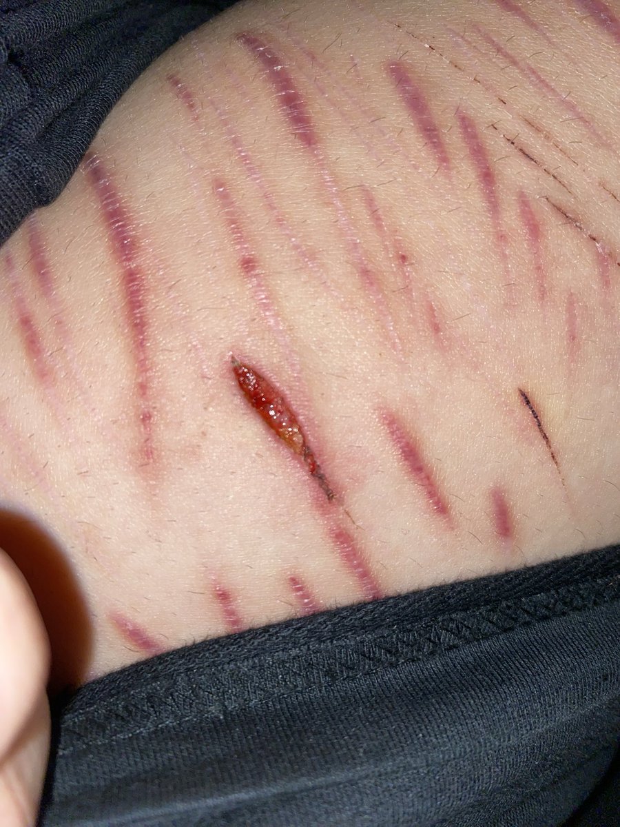 Blot of shedtwt ★ tweet media