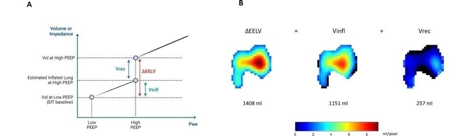 LeslieMegom's tweet photo. 📝El impacto de la PEEP en la presión intracraneal, 🧠💥 la oxigenación en pacientes con lesión cerebral aguda durante la ventilación mecánica.🪭🫁
▪️El uso de presión positiva al final de la espiración mejora la oxigenación y recluta alvéolos, aunque también provoca alteraciones hemodinámicas e incrementa la presión intracraneal.
▪️El síndrome de dificultad respiratoria aguda (SDRA) se desarrolla con frecuencia en pacientes que sufren una lesión cerebral aguda y grave
 📝 Notas cafeteras ☕ 
▪️🧠Los investigadores han postulado varios mecanismos para explicar la relación interdependiente entre la PEEP y la PIC.
▪️ Caricato y Cols demostraron que la hemodinámia cerebral y la PIC no fueron influenciadas por la aplicación de PEEP en pacientes con ⏭️baja compliancia pulmonar (<45 mL/cm H2O )  estos pacientes estaban "protegidos" de mayores aumentos de la PIC⏫🧠 cuando se aplicaban niveles más altos de PEEP porque los pulmones CON MENOR COMPLIANCE  no transmitían⚠️ eficazmente la presión aumentada a todo el espacio intratorácico. 
▪️🧠]. Frost demostró que la aplicación de PEEP entre 5 y 12 cm H 2 O (e incluso transitoriamente hasta 40 cm H 2 O) mejoró la oxigenación arterial☝🏻🤓 sin aumentar la PIC, mientras que Shapiro informó un aumento de >10 mmHg en la PIC en más del 50 % de su cohorte cuando se aplicó PEEP en el rango de 4 a 8 cm H 2 O.
▪️☕Los análisis univariados indicaron que por cada centímetro de aumento de H₂O en la PEEP, los pacientes sin lesión pulmonar aguda experimentaron un aumento de 0,14 mmHg en la PIC.
▪️🧠la PEEP puede aplicarse potencialmente de forma segura AJUSTADA A LAS CONDICIONES de cada paciente, se enfatiza la necesidad de personalizar los ajustes del ventilador para considerar la interacción entre los sistemas nervioso central, respiratorio y cardiovascular.
🧠CONSIDERACIONES IMPORTANTES:
▪️☕La respuesta intracraneal a PEEP depende de la reclutabilidad pulmonar y distribución de gas.
▪️🧠- La oxigenación disminuyó significativamente al reducir PEEP de 14 cmH₂O a 4 cmH₂O.
☕- La presión intracraneal  PI , aumentó de 9 mmHg a 12 mmHg al disminuir PEEP (p < 0.01).
▪️🧠- La presión de perfusión cerebral (CPP) mejoró de 71 mmHg a 75 mmHg (p = 0.03) y la presión arterial media  aumentó de 79 mmHg a 84 mmHg (p < 0.01).
▪️🧠- La relación de reclutamiento (RI) mostró una correlación significativa con el cambio en la PI.
☕- El uso de la maniobra de reclutamiento-inflación (RI) permite evaluar la reclutabilidad pulmonar.
▪️🧠- La tomografía de impedancia eléctrica (EIT) ofrece monitoreo en tiempo real de la distribución regional de la ventilación pulmonar.  
▪️☕- La PaO2 disminuyó de 108 mm Hg a 94 mm Hg al reducir PEEP, mostrando una relación con el RI.
▪️🧠- La compliance estática disminuyó significativamente al pasar de PEEP alto a bajo, afectando a 8 de 10 pacientes.
▪️☕- El índice de inhomogeneidad de EIT mostró una asociación significativa con los cambios en la presión intracraneal (ICP).
▪️🧠PEEP alto puede aumentar la presión intracraneal (PI) al afectar el drenaje venoso cerebral, pero también puede ser seguro al mejorar la oxigenación.
▪️☕- Se observó un aumento en la ΔPaO₂ de 15 ± 10% al cambiar de PEEP alto a bajo, especialmente en pacientes con pulmones más reclutables.
▪️🧠- A PEEP alto, la presión arterial media (MAP) y la presión de perfusión cerebral (CPP) disminuyeron, mientras que la compliance intracraneal aumentó.
▪️☕- La presión venosa central (CVP) superó la ICP a PEEP alto, sugiriendo un impacto negativo en el drenaje venoso cerebral.
▪️🧠- La mecánica pulmonar heterogénea modula el impacto del PEEP en la PI con un aumento en la compliance de 58% y una pérdida de 42% en compliance.
▪️☕- La inhomogeneidad en la distribución de gas fue un factor clave asociado con los cambios en la ICP, destacando la importancia de la distribución del gas en el pulmón.👇🏽 cont.
▪️