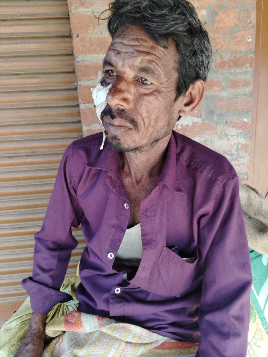 #बाराबंकी:- दबंगों ने युवक को लाठी डंडों से जमकर पीटा।युवक को आई गंभीर चोटें।सुबेहा थाने में दर्ज हुई एफ आई आर। अभी तक नहीं हुआ मेडिकल।सुबेहा पुलिस की बड़ी लापरवाही।सुबेहा थाना क्षेत्र के पूरे इच्छा का है मामला। <a href="/Uppolice/">UP POLICE</a> <a href="/dgpup/">DGP UP</a> <a href="/Barabankipolice/">Barabanki Police</a> <a href="/inforBarabank/">DM barabanki</a> <a href="/igrangeayodhya/">DIG Range Ayodhya</a>