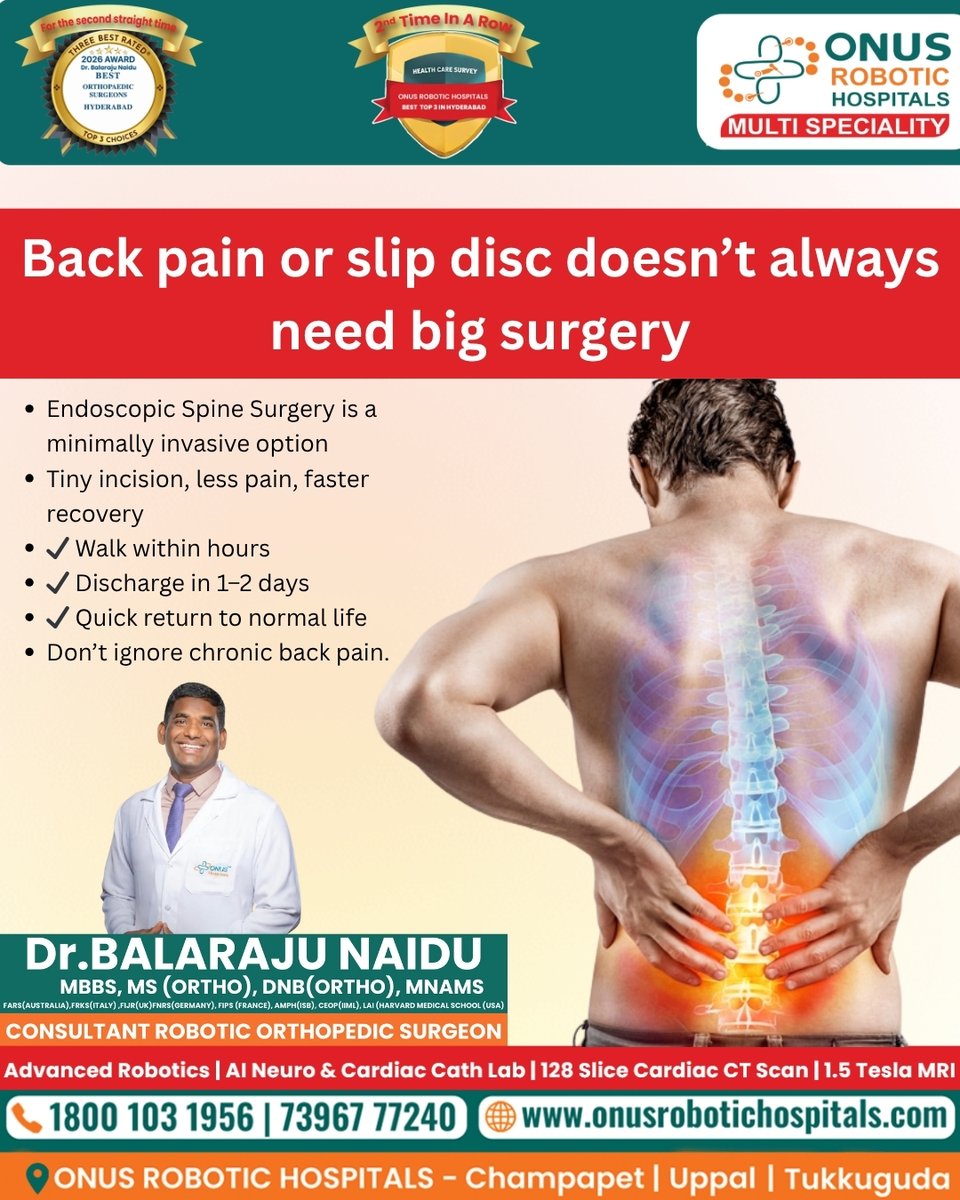 Dr_BalrajuNaidu's tweet image. Back pain or slip disc doesn’t always need big surgery ❌
Endoscopic spine surgery =
✔ Tiny incision
✔ Less pain
✔ Faster recovery

Walk within hours.

📍 Champapet | Uppal | Tukkuguda
📞 1800 103 1956
🌐 zurl.co/SXlbV

#BackPain #SlipDisc #SpineCare #MinimalInvasive