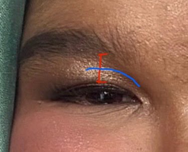 eajparkir's tweet photo. @ohmy_beautybank Jarak mata ke alis itu maksudnya yg garis merah yaa

Nah jadi kasih eyeshadow shimmer nya sampai batas garis biru ajaa
Tujuannya biar jarak mata dan alis nya itu ga keliatan semakin pendek dan kesannya ga “kepenuhan” eyelid nyaah https://t.co/GlT8atwSwm