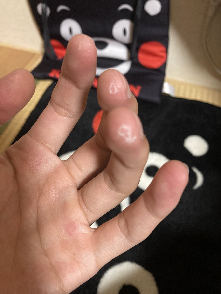 しょんぽぽ tweet media