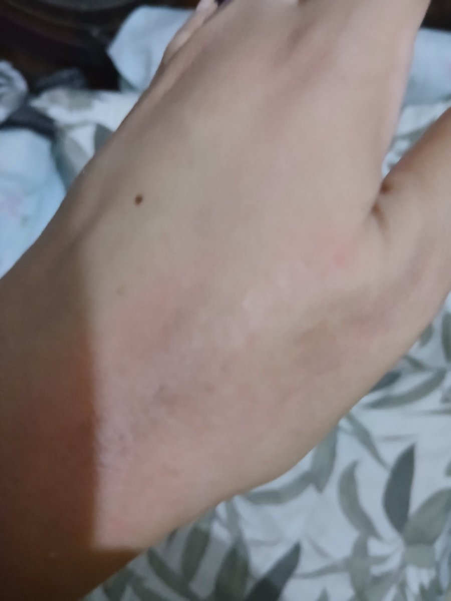 dearest_athena's tweet image. No one cares whether its heart burn or hand burn.....🩵💫

#selfcare