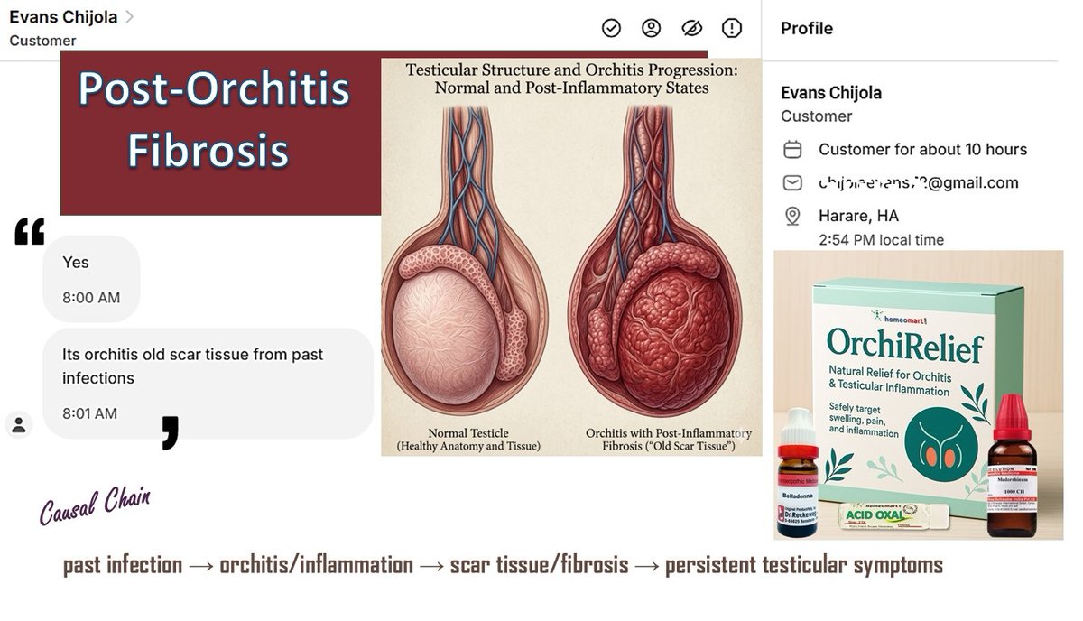Are you experiencing lingering discomfort from old orchitis like Evans ? Learn what post-inflammatory fibrosis is, how to identify it, and rubric based homeopathic remedies wp.me/p6CQsw-FJx
