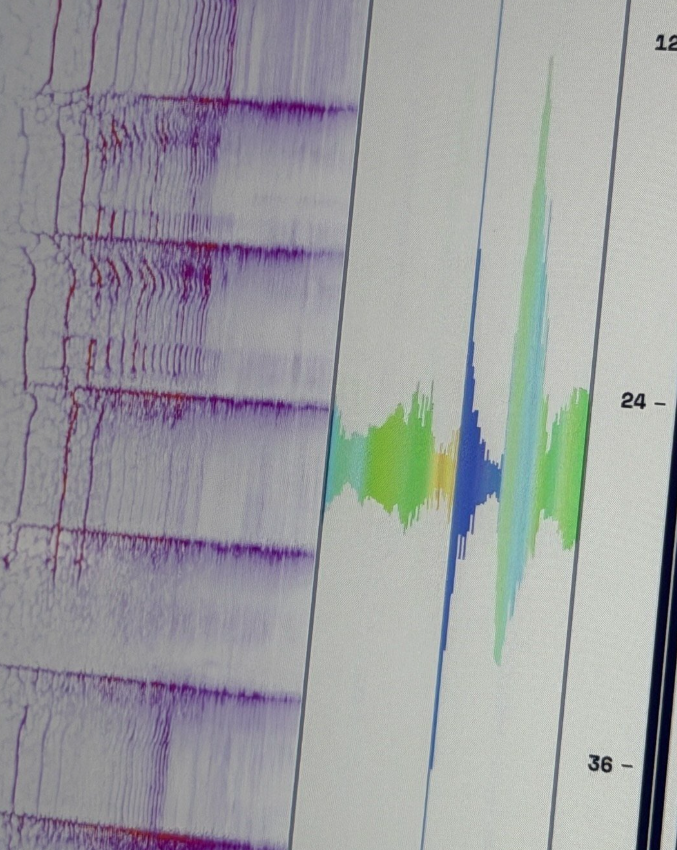 About Music tweet media