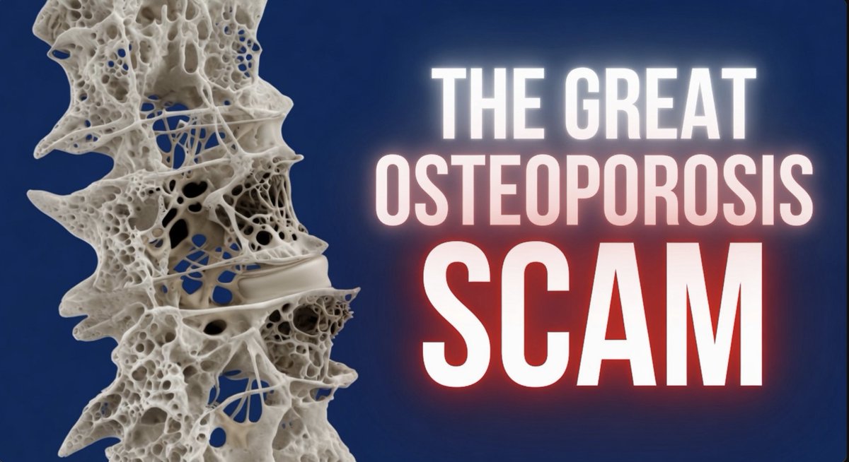 THE GREAT OSTEOPOROSIS SCAM

For decades, Big Pharma convinced us that normal aging bones are a disease called osteoporosis. They invented the diagnosis, created the drugs, and sold them to millions — all built on a lie.

The cruel irony? Their first-line treatments