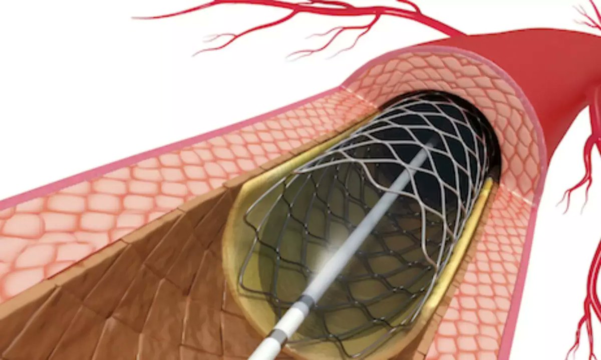 CardiovascularCorner tweet media