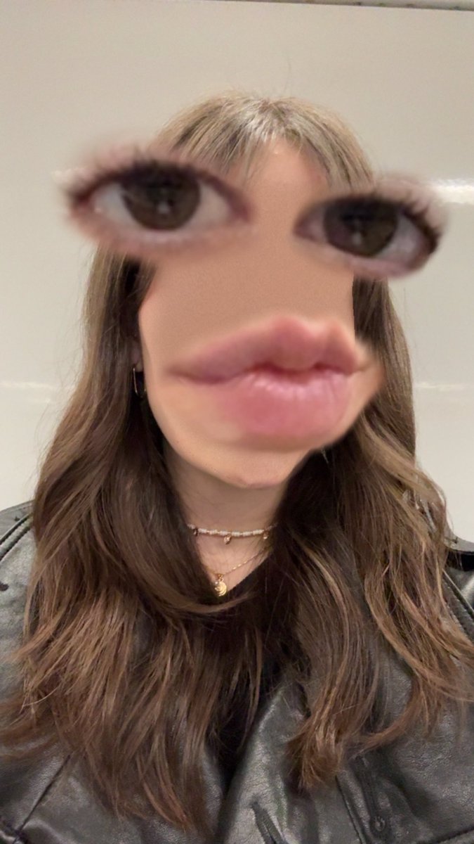 ˣᵉᵗⁱᵗᵒˢ tweet media