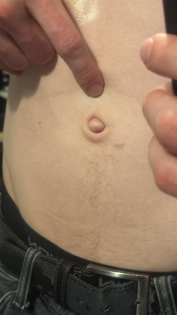 Jim Koopar tweet media