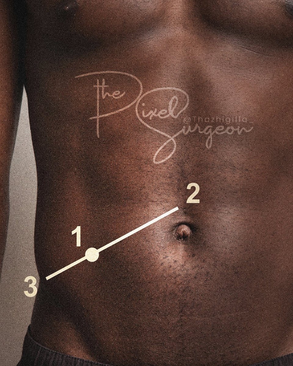 Thazhigilla_'s tweet image. Name the spot marked ''1''
State the exact clinical significance. 
#MedTwitter #MedX