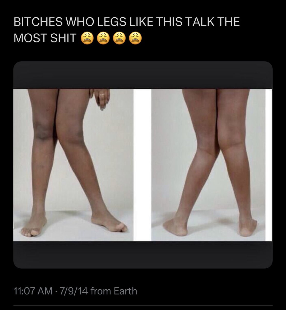 alopecia chlamydia tweet media