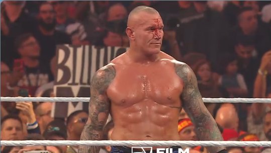 WWE managed to ruin a match I was so hyped to see in every way possible. Some of the most horrible booking I have laid my eyes on.