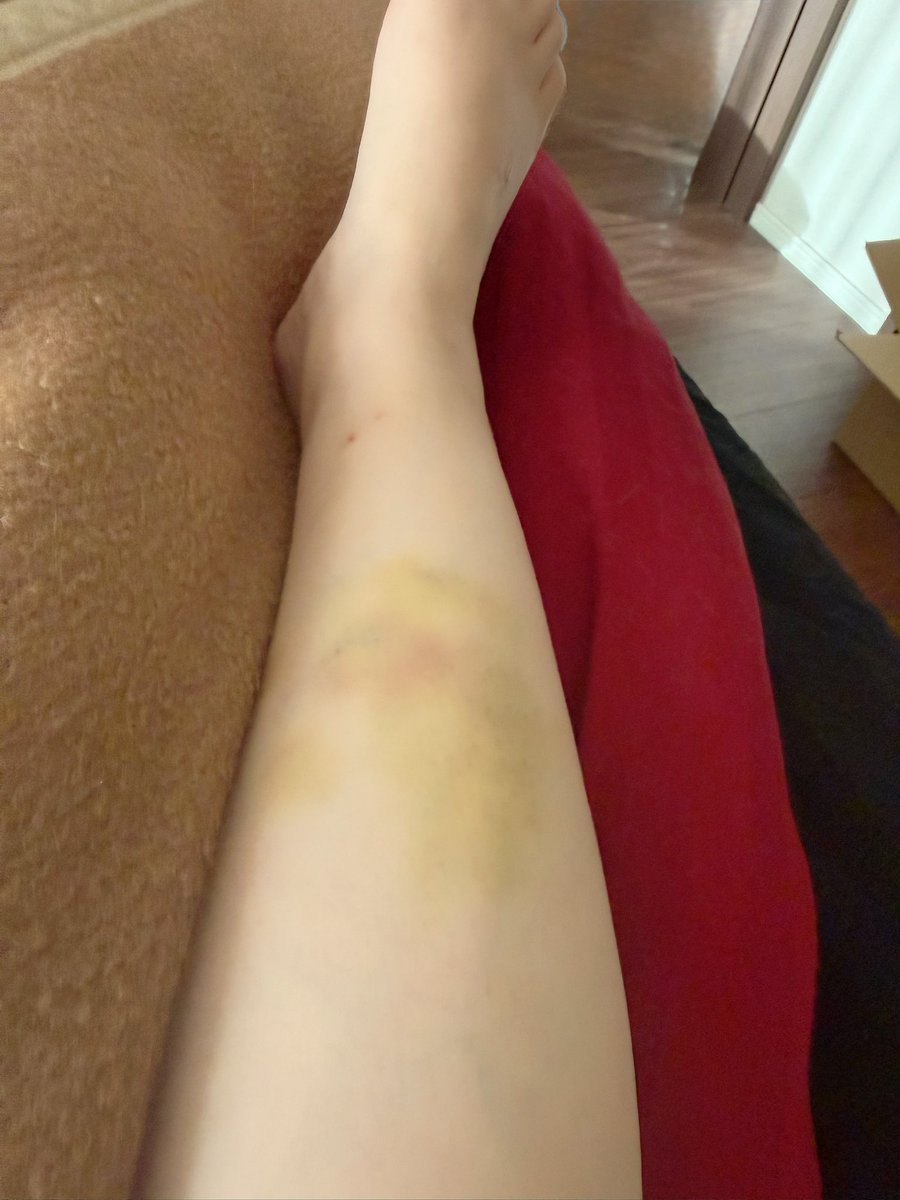 豹くん🐱 tweet media