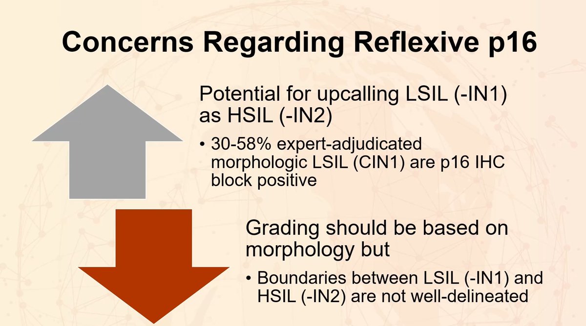 Janiranavarro's tweet photo. Cervical biopsy
What is your diagnosis?
p16 looks block positive

Pitfalls of reflex p16 testing: Potential for upcalling LSIL (-IN1) as HSIL (-IN2)
30-58% expert-adjudicated morphologic LSIL (CIN1) are p16 positive
***Grading should be based on morphology***

Dr. Kong #USCAP2026 #pathology #PathX #PathTwitter #everydayGYN