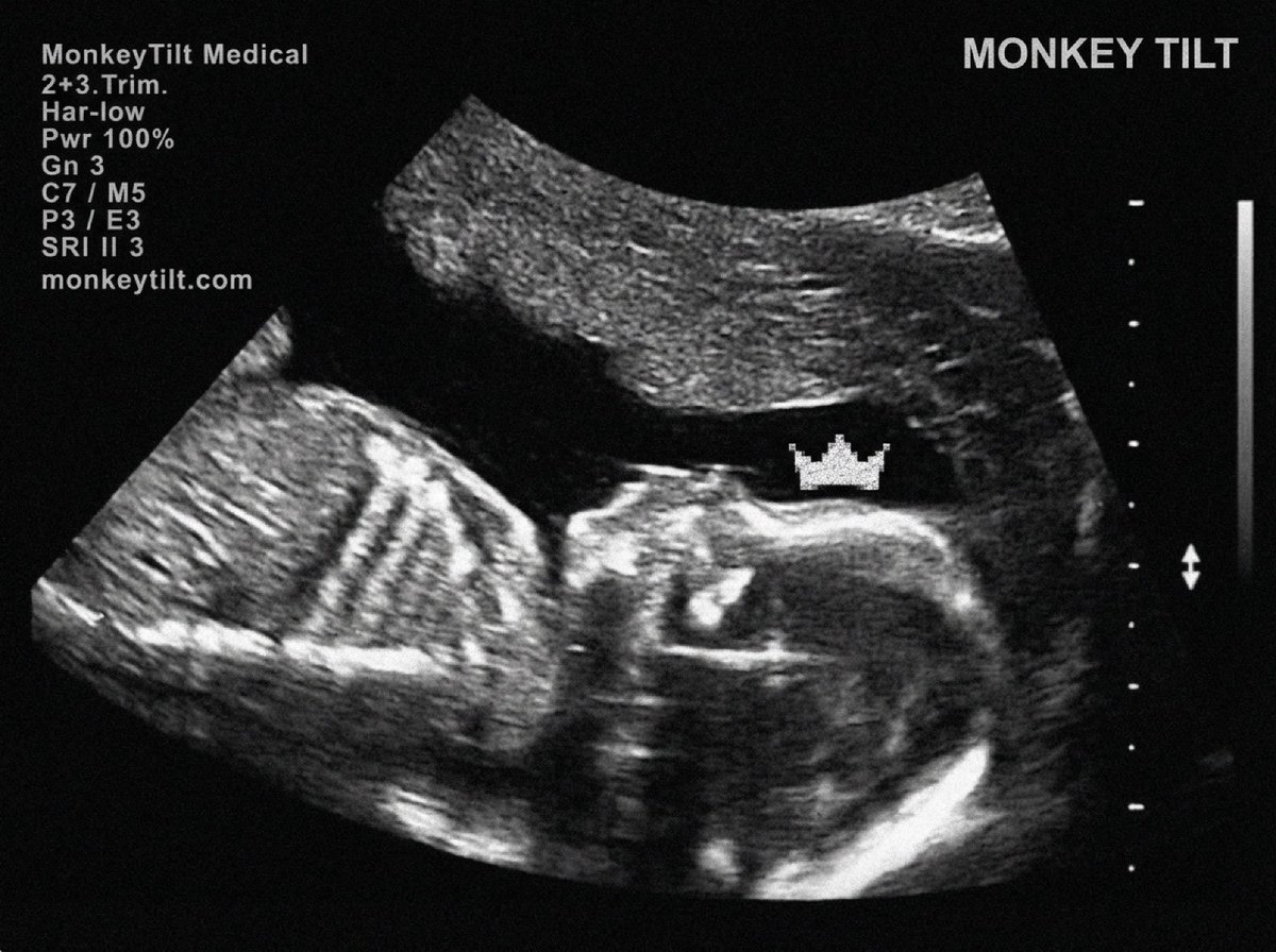 Monkey Tilt tweet media