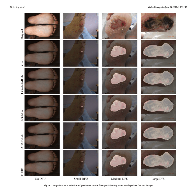 DGArmstrong's tweet image. The Diabetic Foot Ulcers Grand Challenge: Advancing Medical Image Segmentation #AIML #Image #AI #ActAgainstAmputation diabeticfootonline.com/2024/04/08/169…