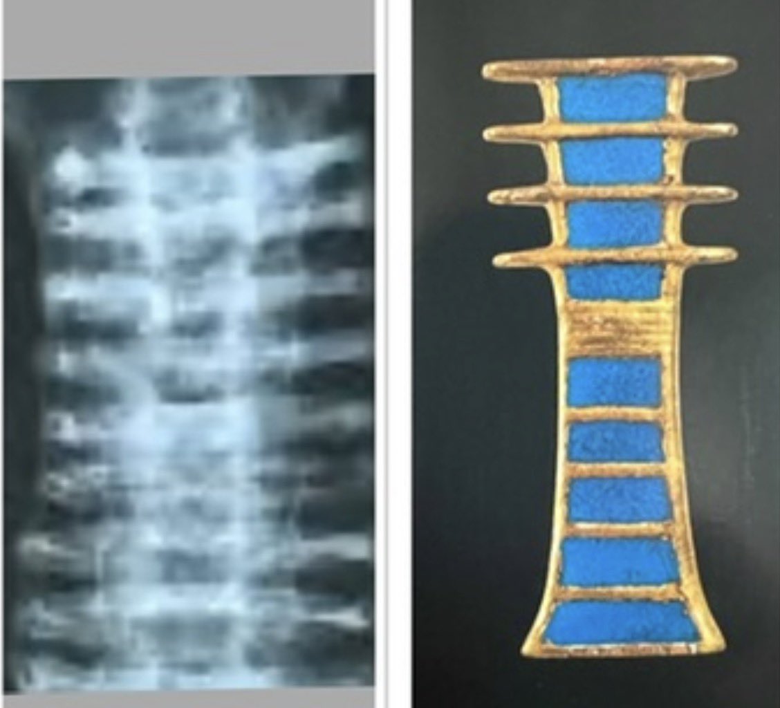 JonStewartIL's tweet image. A spine from a Nazca Mummy and an Egyptian Amulet called “The Spine of Osiris”. 

Could it be that Osiris WAS an ET and had the same skeletal makeup of a Peruvian Mummy?? I think the similarity is NO coincidence. What say you? 

#aliens #Egypt #nazcamummies