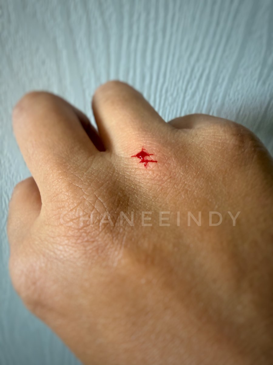 🐽 🅒Ⓗ🅐Ⓝ🅔Ⓔ🅘Ⓝ🅓Ⓨ 🐽 tweet media