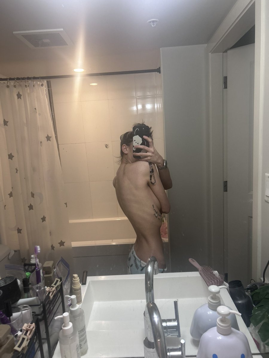 this comment actually pisses me off. 
you clearly don’t know fuck all about bodies 
you CAN lose all that in a year
i didn’t lose because i wanted to, a disease took that from me 

for reference:
mid 2025 and late 2025