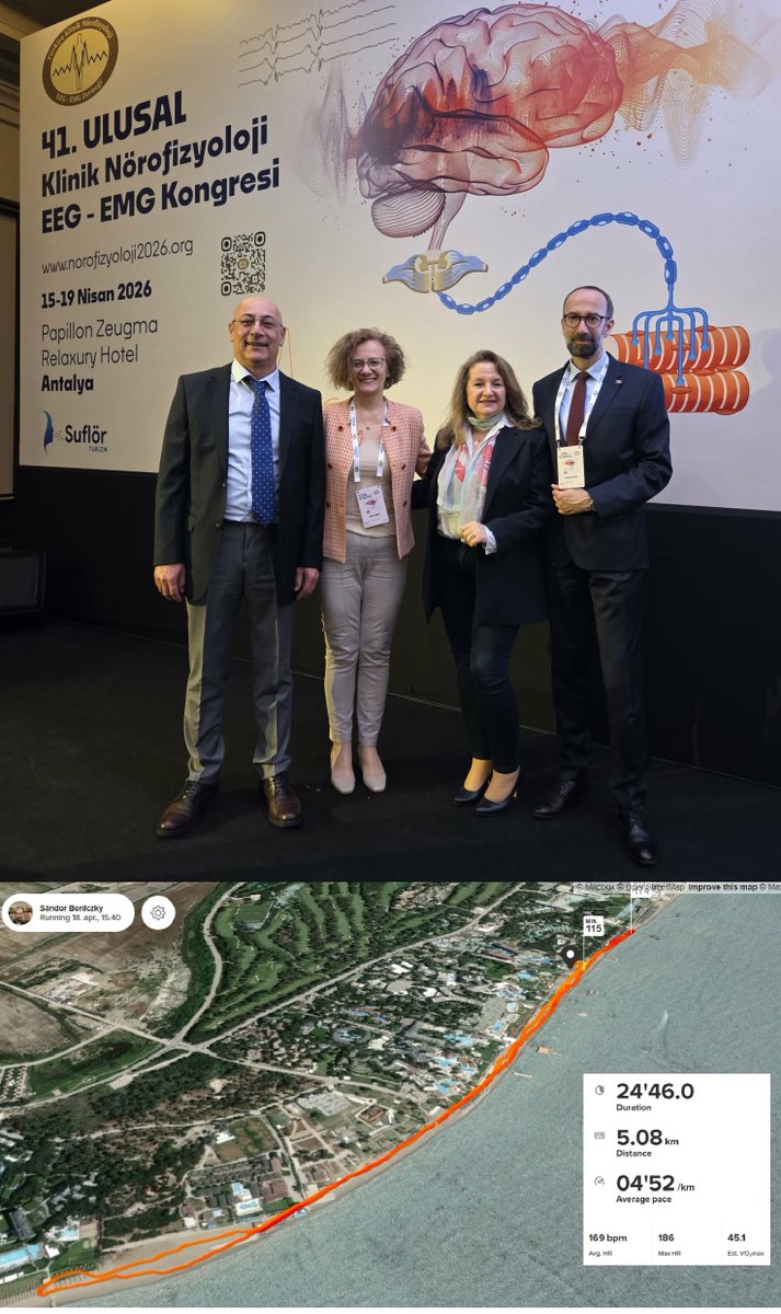 SBeniczky's tweet image. It has been a great pleasure talking about seizure classification and about AI in EEG, at the Turkish congress on clinical neurophysiology.
And a nice late evening run :)
#EEG #epilepsy #AI @ClinicalNeuroph