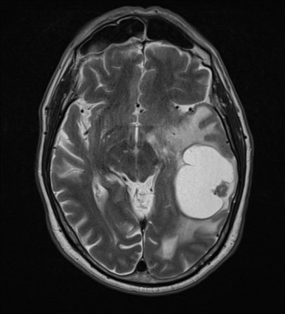 RADIOLOGISTS tweet media