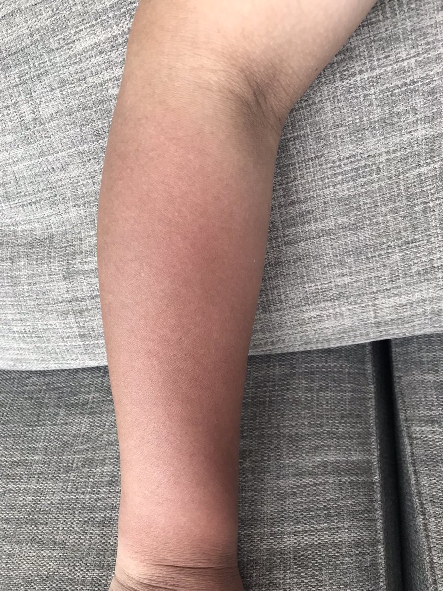 ウルトラソー＠東三国エリア長 tweet media