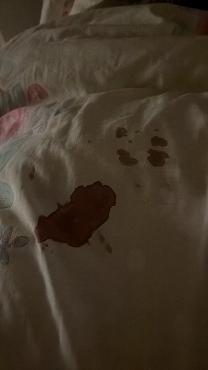 ceaseddtoexist's tweet photo. funny little stains just gotta keep covering them with my blanket so mother don’t see uhhhhg, wait till it’s nice and old brown so it looks very old and me no trouble yes, i use a fricking black blanket beneath my arm tho idk how df that happens #shtwt https://t.co/SUIgR9isO5