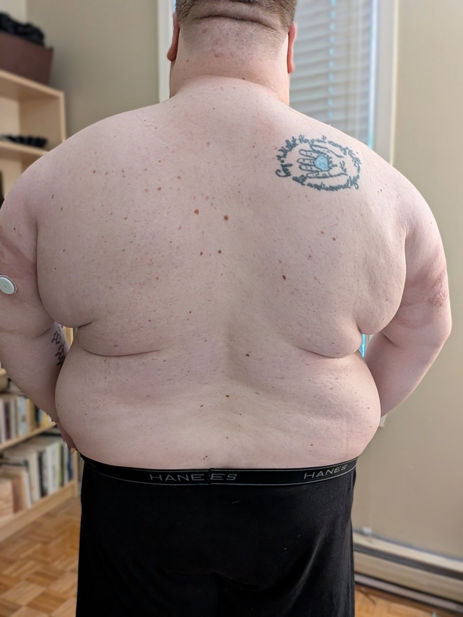 Big Back beefcake 🍖