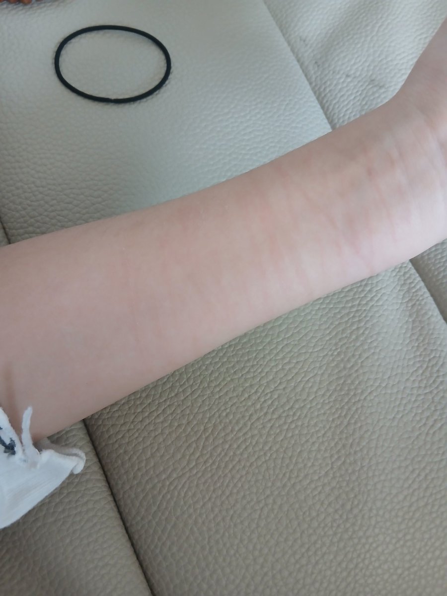 EunJbe0910's tweet photo. 넹 패션자해 아니구여 패고싶으면 패주세여 ㅎ
나보고 패션자해라네 ㅜㅜ 나 혼자 커터칼로 열시미 긋고잇으니까 꺼뎌 💗💗💗 https://t.co/gXluZjOdcf
