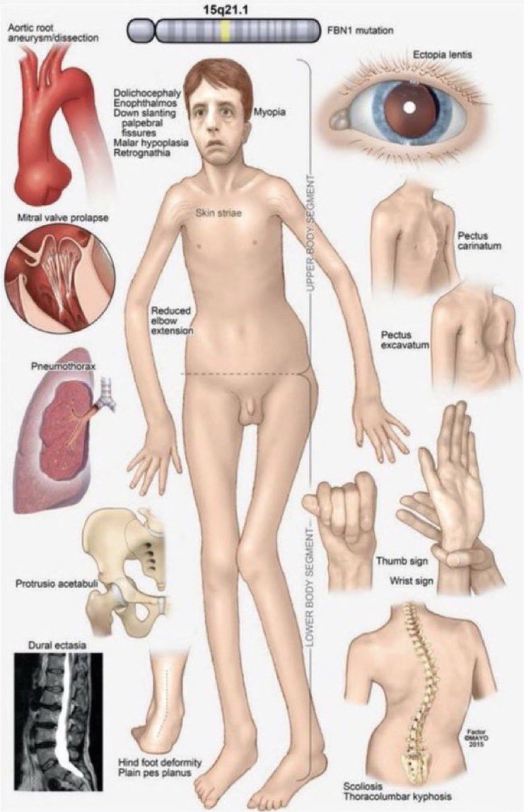 sharon vape 𓆝 ⋆｡𖦹°‧🫧 tweet media