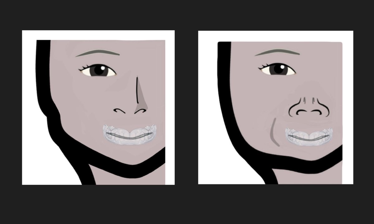 戸塚哲春の卵顔トレーニング tweet media