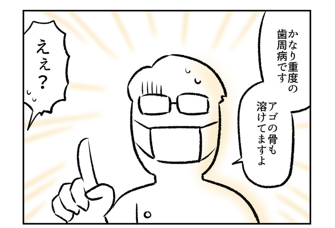 (2/2)
顎の骨が溶けてる??💦

◆
「歯医者さんに歯が全部なくなると言われた話」の続きはこちらから最後まで無料で読めます〜!🙇🦷
↓
https://t.co/DFj1kVbkLZ 