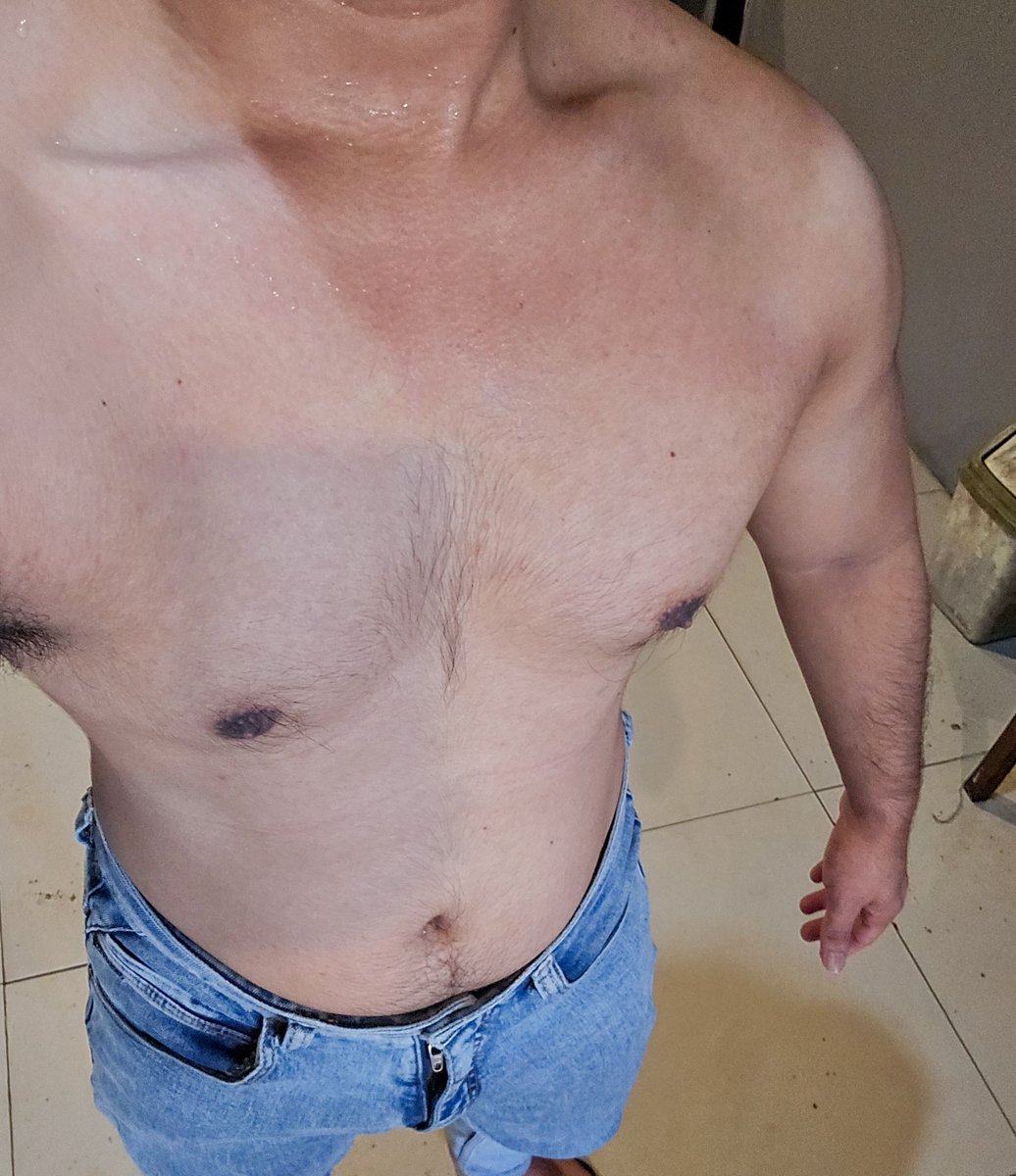 odontolicious's tweet photo. alhamdulillah no bekas bekas 😝 thanks to all the doctors! https://t.co/oiDHewMFgI