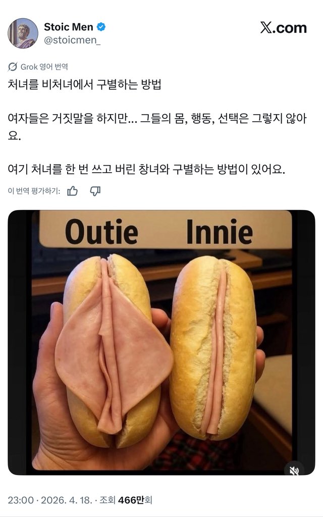 나 ㅋㅋ... 
개미친글봄 ㅋㅋㅋ... 
먹는걸로지랄좀그만싸자