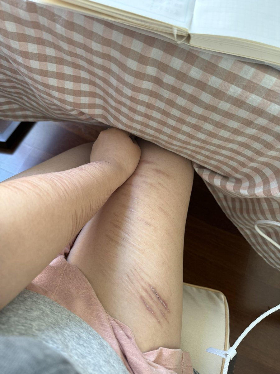 血滴子 tweet media