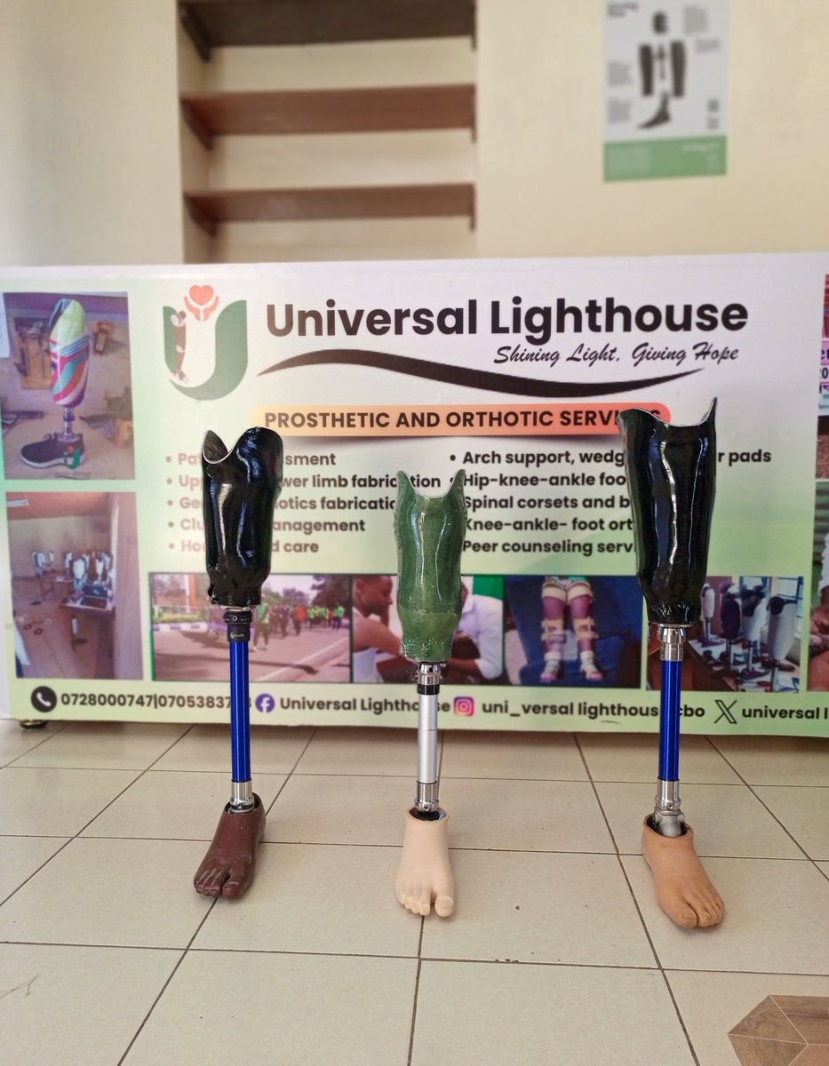 ULHouseCBO's tweet photo. We don’t just build prosthetics; we walk the journey with every individual we serve.

Through innovation and patient-centred care, we create custom solutions that restore mobility, comfort, and confidence; one limb at a time.

#LLLDAM #ActiveLimbsActiveLife #AssistiveDevices #ulh https://t.co/b8XuFLtK2l