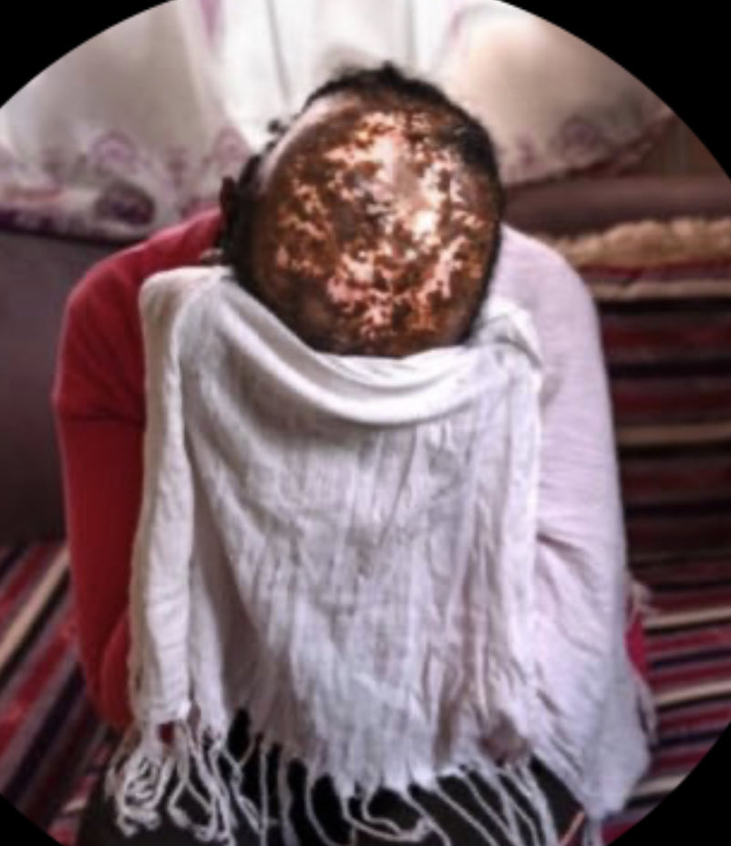 saba_t12's tweet image. 📢❗ CONCLUSION
The pattern:
• Violations documented • Actors identified • Accountability lacking
This is the “law of force” in action.
Enforce the law. Enable return.
#Tigray #AccountabilityNow #RightToReturn @antonioguterres @ymahmoudali
@saba_t12