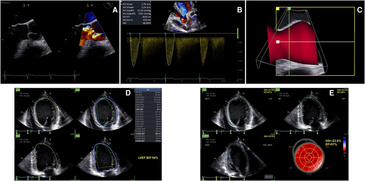European Society of Cardiology Journals tweet media