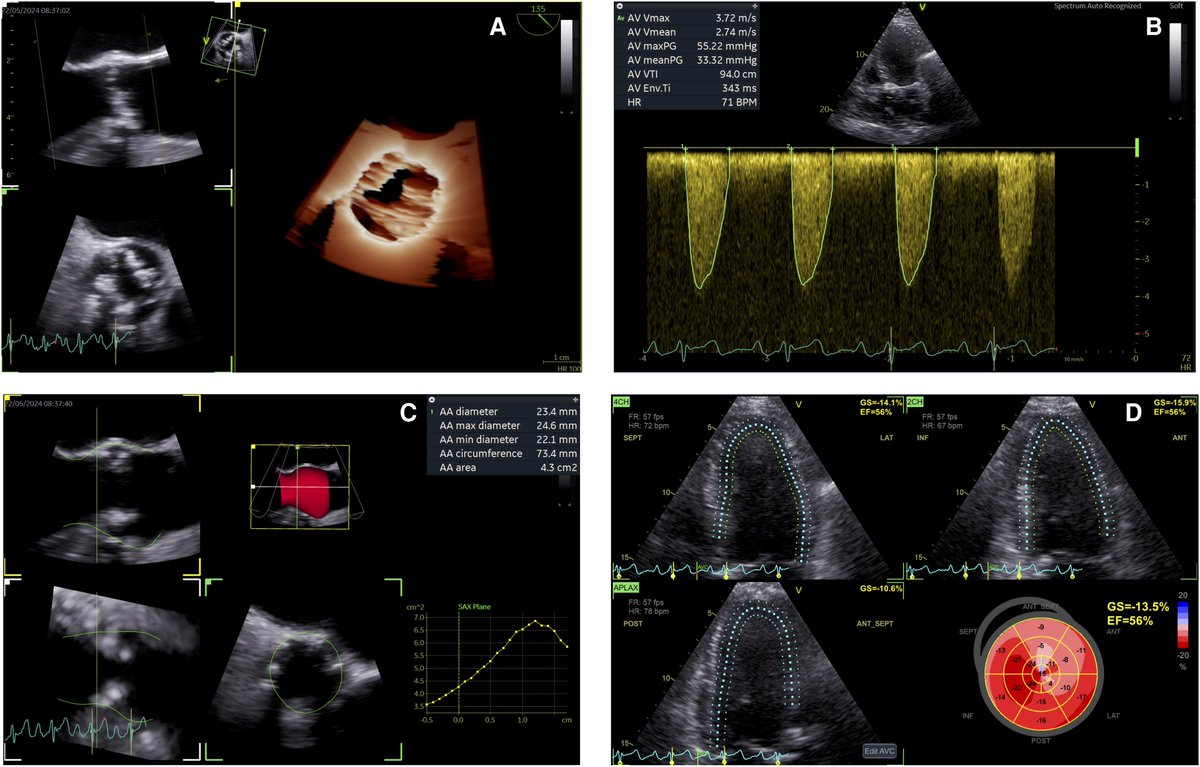 European Society of Cardiology Journals tweet media