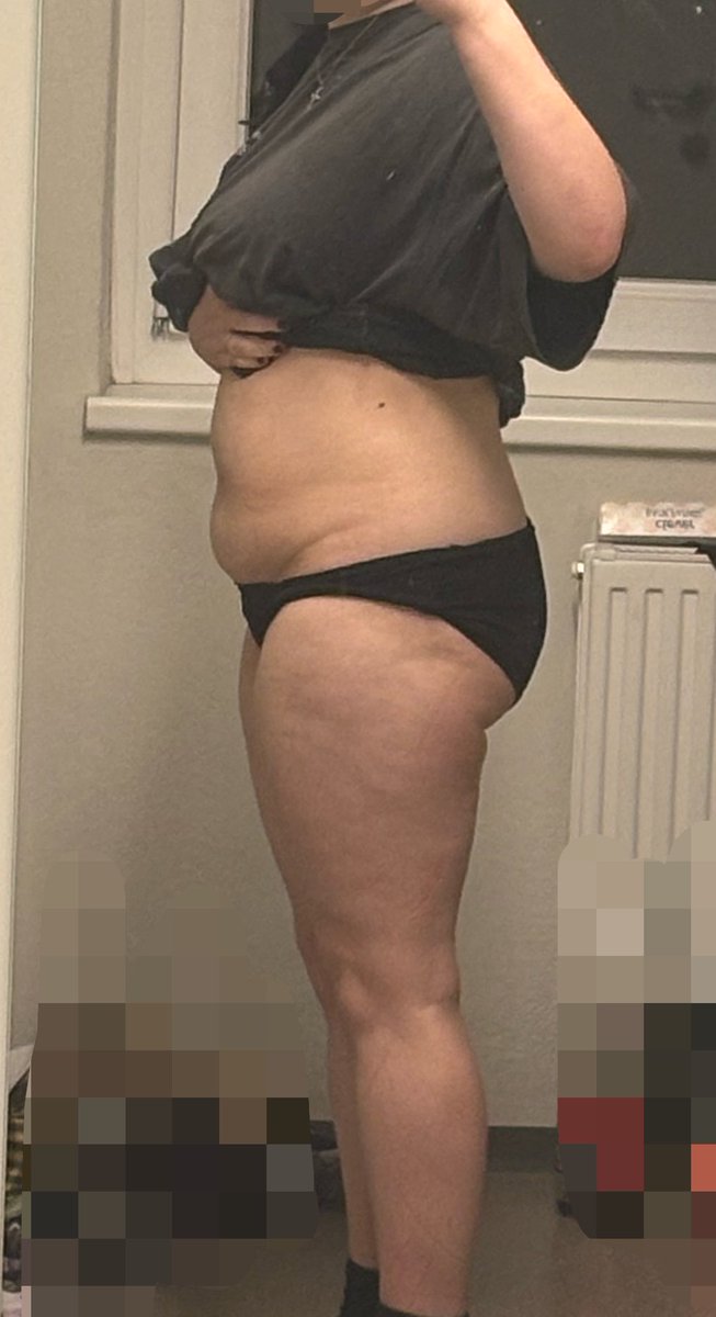 IwaHatesU's tweet image. Sometimes I forget how much changed. Funny to think that I feel no different. 
You really don’t see how big you are until you lose weight…
#edtwt #weightloss #comparisonspo