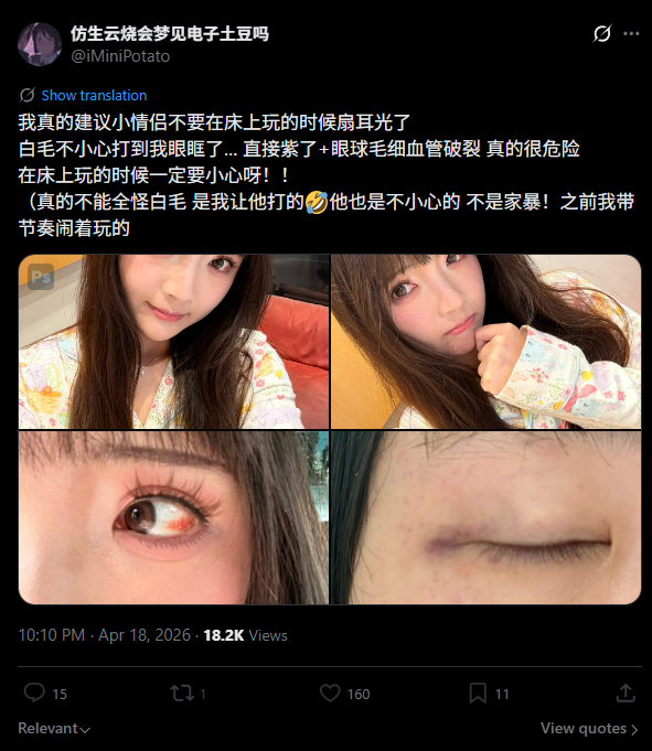 鼠仁侠☝️🐭 tweet media