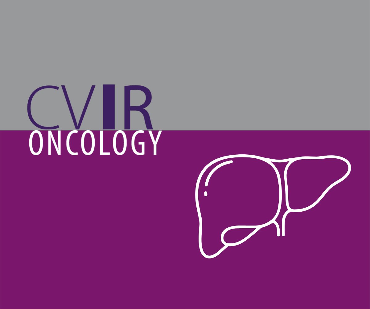 cvironco's tweet image. On #WorldLiverDay, we’re highlighting a selection of articles from CVIR Oncology that dive into the topic of image-guided and minimally invasive interventional techniques for cancer treatment.

Explore the collection: cvironcology.org/for-readers/li…

#InterventionalOncology #IRad