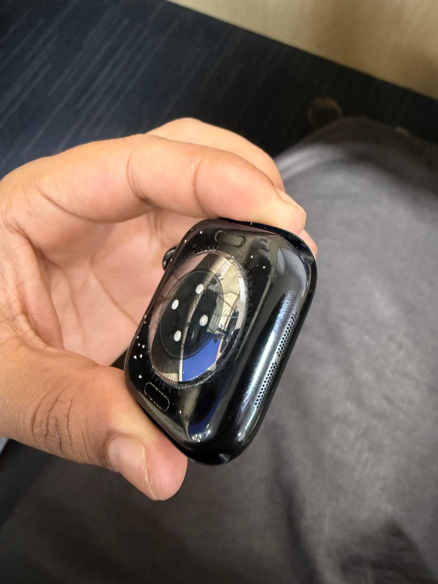 AkashCh19034967's tweet image. Is this the premium quality @Apple is known for? My Apple Watch Series 10 is severely peeling and bubbling! Purchased from @UnicornAPR, and this level of degradation? massive manufacturing defect. I need a replacement ASAP! @AppleSupport @tim_cook @Apple
#AppleWatch #AppleSupport