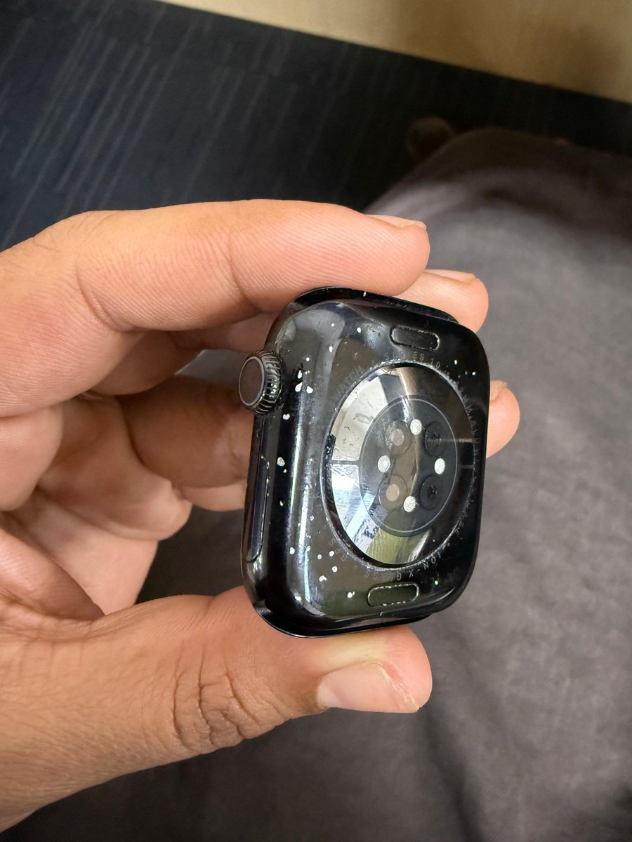 AkashCh19034967's tweet image. Is this the premium quality @Apple is known for? My Apple Watch Series 10 is severely peeling and bubbling! Purchased from @UnicornAPR, and this level of degradation? massive manufacturing defect. I need a replacement ASAP! @AppleSupport @tim_cook @Apple
#AppleWatch #AppleSupport