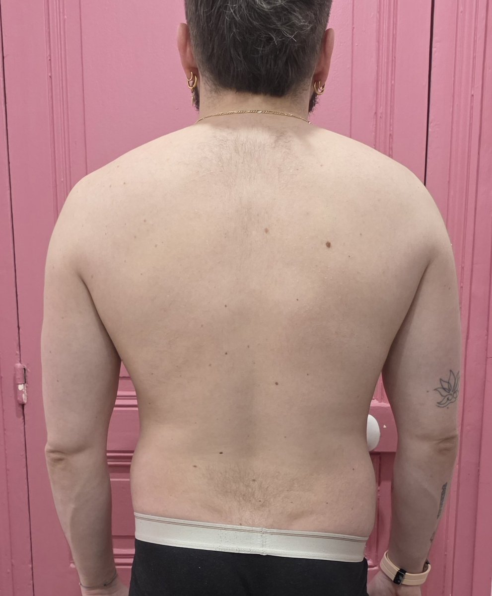 Tino 🧔🏼‍♂️ / Barbatata 🧔🏼‍♀️ tweet media