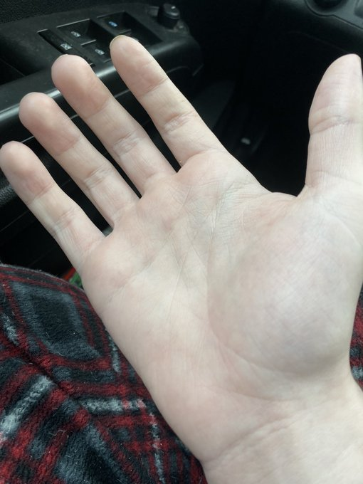 and more tweet media