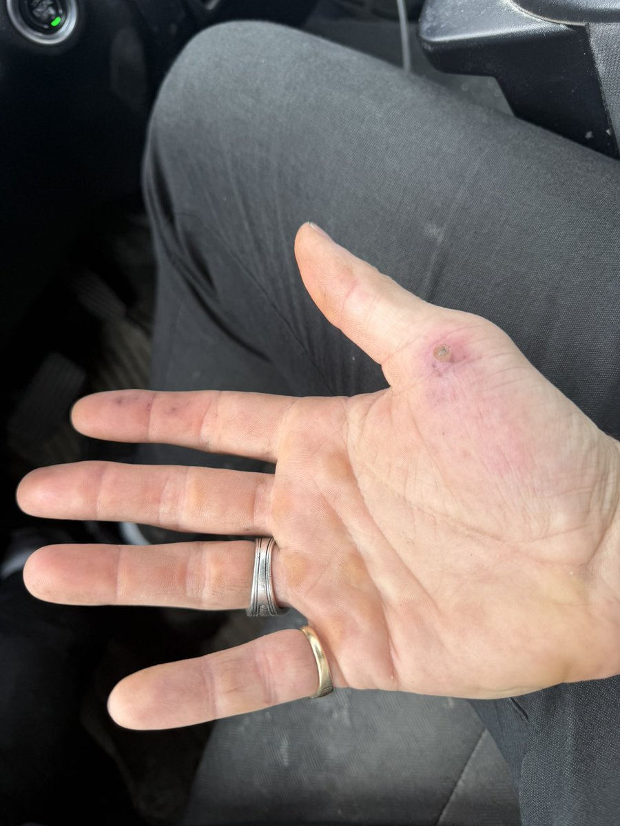 TommyGun717's tweet image. #Working #Hands