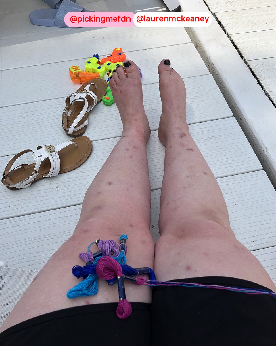 PickingMeFdn's tweet photo. "How can I have something so visible, yet still feel so unseen?" - CEO @laurenmckeaney

Living with #SkinPickingDisorder can feel isolating and leave you feeling misunderstood.

Learn how Lauren went from silent sufferer to adamant advocate at https://t.co/bd3mWs5BUq! https://t.co/XuhJmdhiMQ