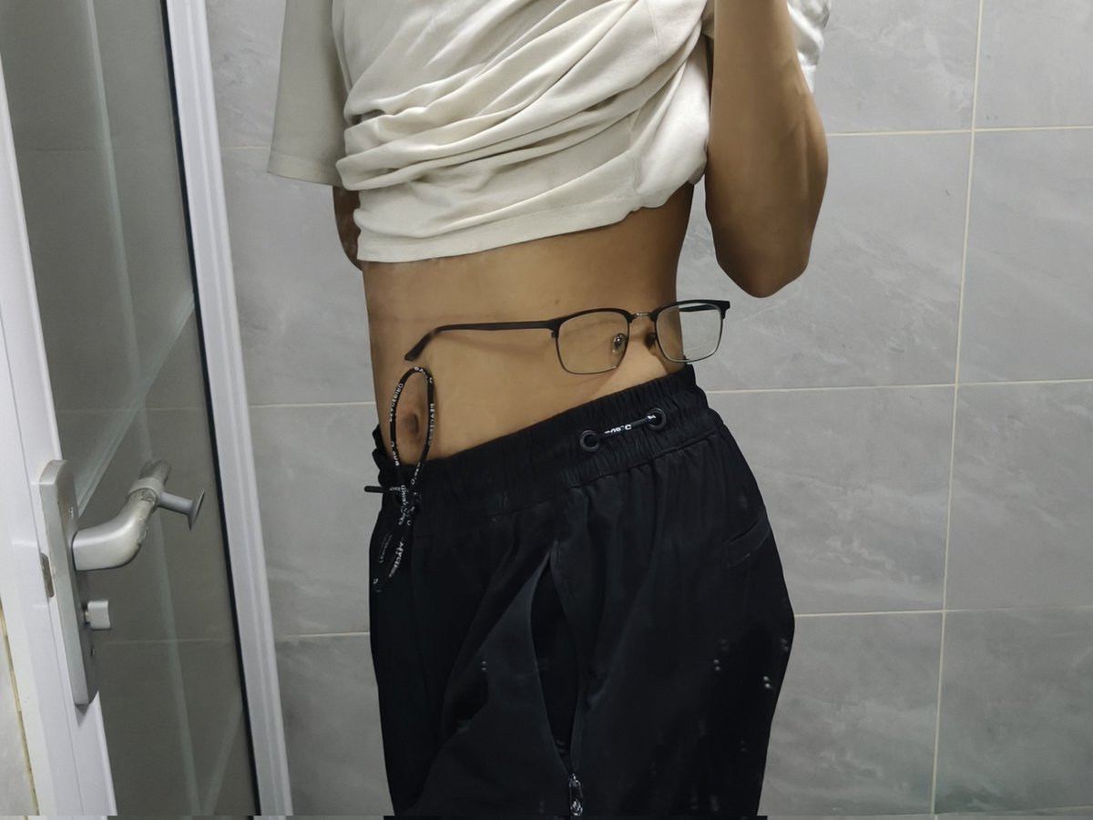 🌈对异丁苯丙酸 tweet media